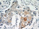 MAGEA4 Antibody in Immunohistochemistry (Paraffin) (IHC (P))