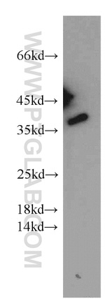MAGEA4 Antibody in Western Blot (WB)