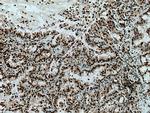 USP22 Antibody in Immunohistochemistry (Paraffin) (IHC (P))