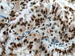 USP22 Antibody in Immunohistochemistry (Paraffin) (IHC (P))