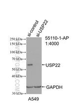USP22 Antibody in Western Blot (WB)