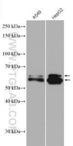 USP22 Antibody in Western Blot (WB)
