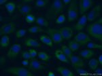 TRPM1 Antibody in Immunocytochemistry (ICC/IF)