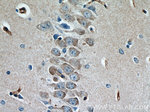NOTCH3 Antibody in Immunohistochemistry (Paraffin) (IHC (P))