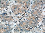 NPR1 Antibody in Immunohistochemistry (Paraffin) (IHC (P))