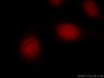 EGR1 Antibody in Immunocytochemistry (ICC/IF)