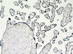 EGR1 Antibody in Immunohistochemistry (Paraffin) (IHC (P))