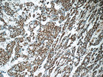EGR1 Antibody in Immunohistochemistry (Paraffin) (IHC (P))