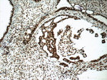 EGR1 Antibody in Immunohistochemistry (Paraffin) (IHC (P))