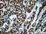 EGR1 Antibody in Immunohistochemistry (Paraffin) (IHC (P))