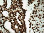 EGR1 Antibody in Immunohistochemistry (Paraffin) (IHC (P))