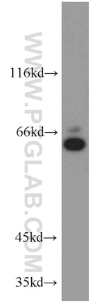 WEE2 Antibody in Western Blot (WB)