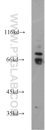 WEE2 Antibody in Western Blot (WB)