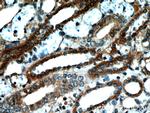 NUDT19 Antibody in Immunohistochemistry (Paraffin) (IHC (P))
