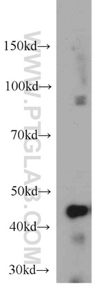 NUDT19 Antibody in Western Blot (WB)