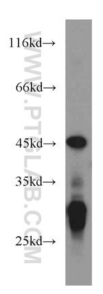NUDT19 Antibody in Western Blot (WB)