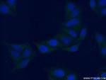 PSAPL1 Antibody in Immunocytochemistry (ICC/IF)