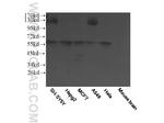 PSAPL1 Antibody in Western Blot (WB)