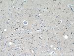 PPP1R9B Antibody in Immunohistochemistry (Paraffin) (IHC (P))