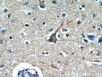 PPP1R9B Antibody in Immunohistochemistry (Paraffin) (IHC (P))