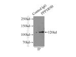 PPP1R9B Antibody in Immunoprecipitation (IP)