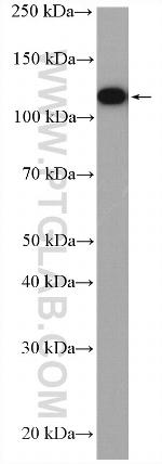PPP1R9B Antibody in Western Blot (WB)
