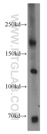 PPP1R9B Antibody in Western Blot (WB)