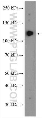 PPP1R9B Antibody in Western Blot (WB)