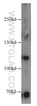 PPP1R9B Antibody in Western Blot (WB)