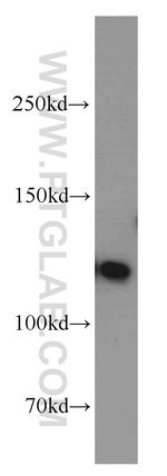PPP1R9B Antibody in Western Blot (WB)