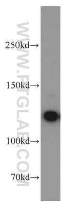 PPP1R9B Antibody in Western Blot (WB)