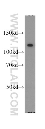 PPP1R9B Antibody in Western Blot (WB)