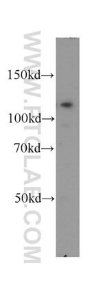 PPP1R9B Antibody in Western Blot (WB)