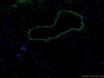 Alpha SMA Antibody in Immunohistochemistry (PFA fixed) (IHC (PFA))