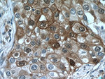 LTB4R Antibody in Immunohistochemistry (Paraffin) (IHC (P))