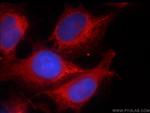 PRKG2 Antibody in Immunocytochemistry (ICC/IF)