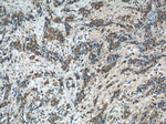 CAPZA1 Antibody in Immunohistochemistry (Paraffin) (IHC (P))