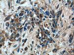 CAPZA1 Antibody in Immunohistochemistry (Paraffin) (IHC (P))