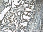 CAPZA1 Antibody in Immunohistochemistry (Paraffin) (IHC (P))