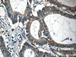 CAPZA1 Antibody in Immunohistochemistry (Paraffin) (IHC (P))