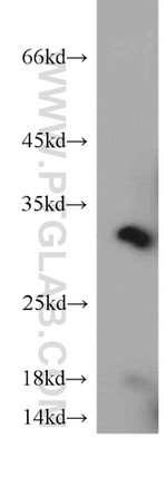 CAPZA1 Antibody in Western Blot (WB)