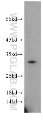 CAPZA1 Antibody in Western Blot (WB)
