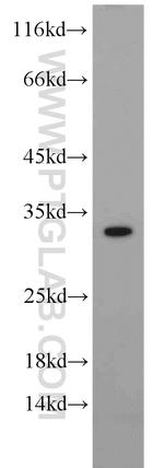 CAPZA1 Antibody in Western Blot (WB)