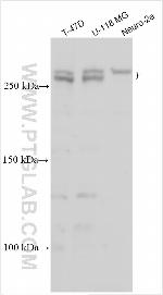 STON1 Antibody in Western Blot (WB)