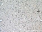 PARP2 Antibody in Immunohistochemistry (Paraffin) (IHC (P))