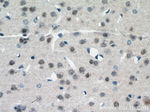 PARP2 Antibody in Immunohistochemistry (Paraffin) (IHC (P))