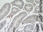 PARP2 Antibody in Immunohistochemistry (Paraffin) (IHC (P))