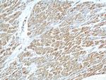 PPP1CC Antibody in Immunohistochemistry (Paraffin) (IHC (P))