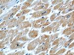 PPP1CC Antibody in Immunohistochemistry (Paraffin) (IHC (P))