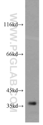 PPP1CC Antibody in Western Blot (WB)